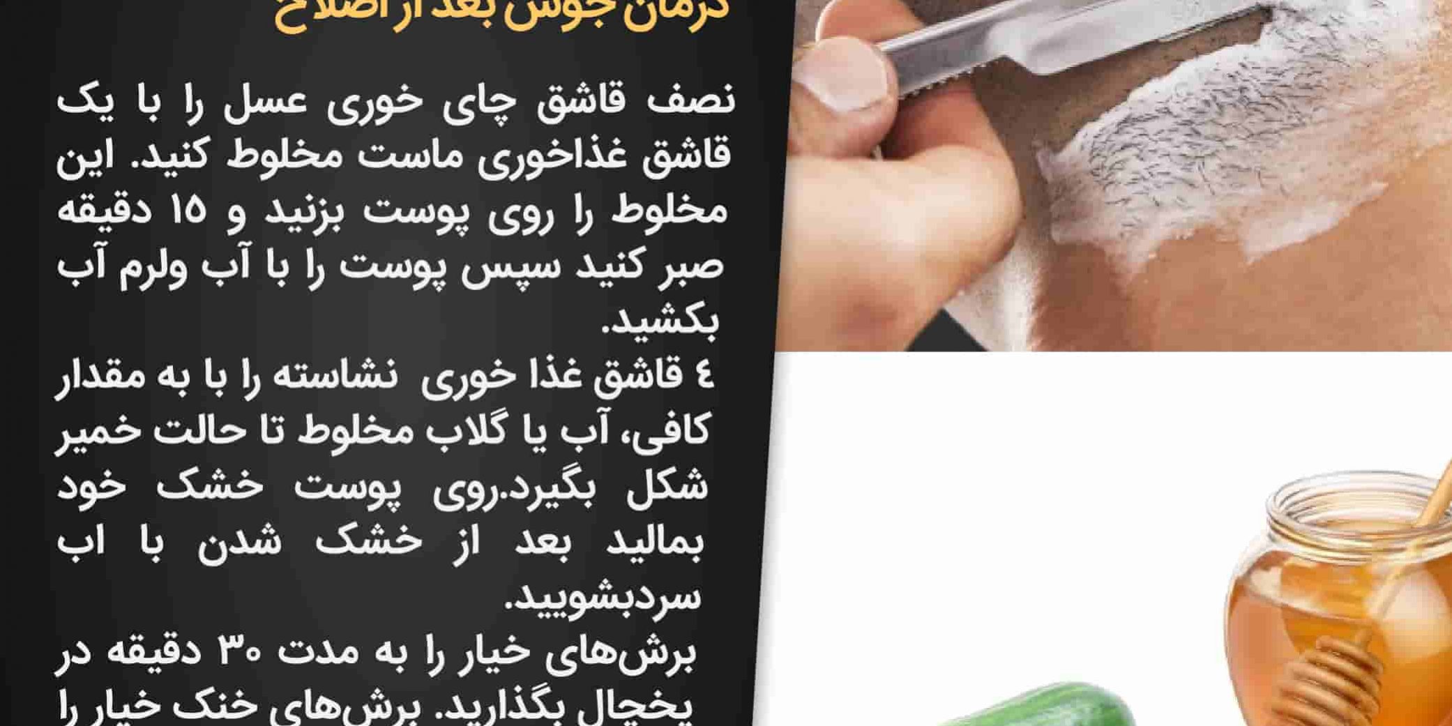 جوش زدن بعد از اصلاح
