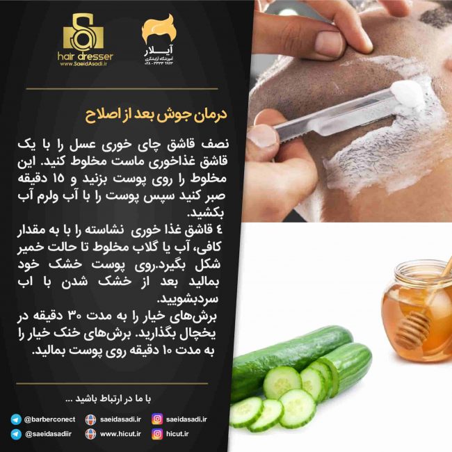 جوش زدن بعد از اصلاح