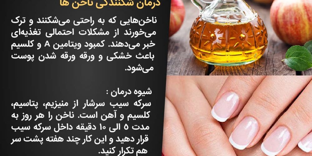 خشکی ناخن و سرکه سیب