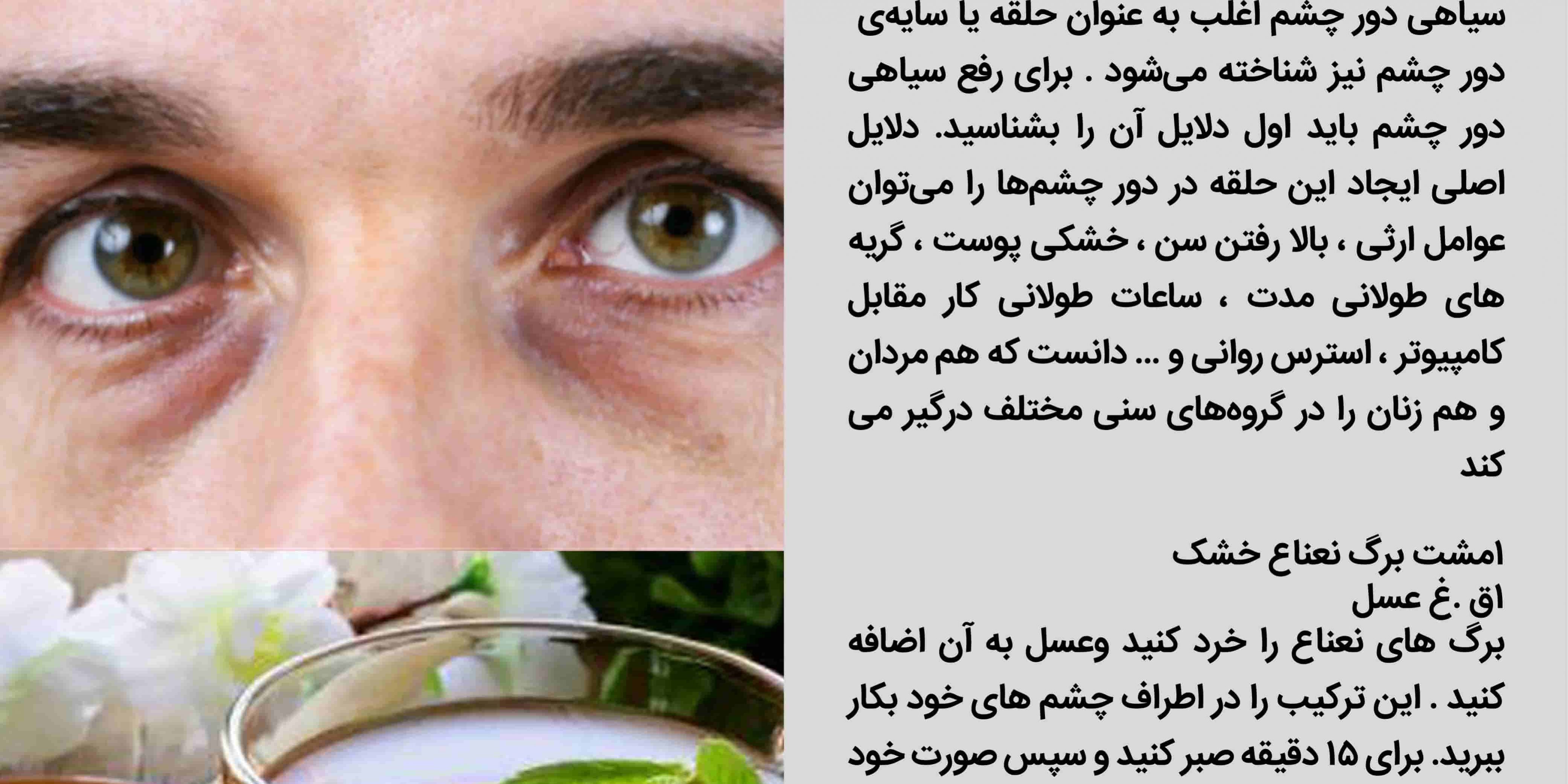 درمان سیاهی دور چشما