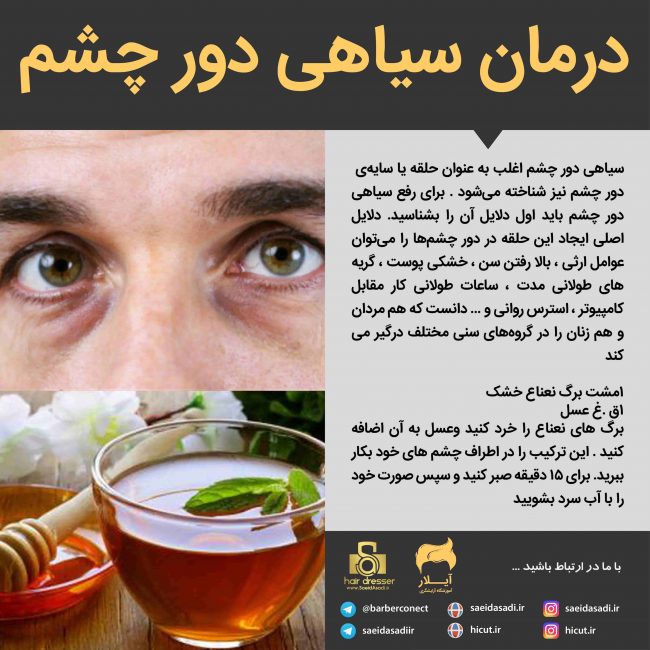 درمان سیاهی دور چشما