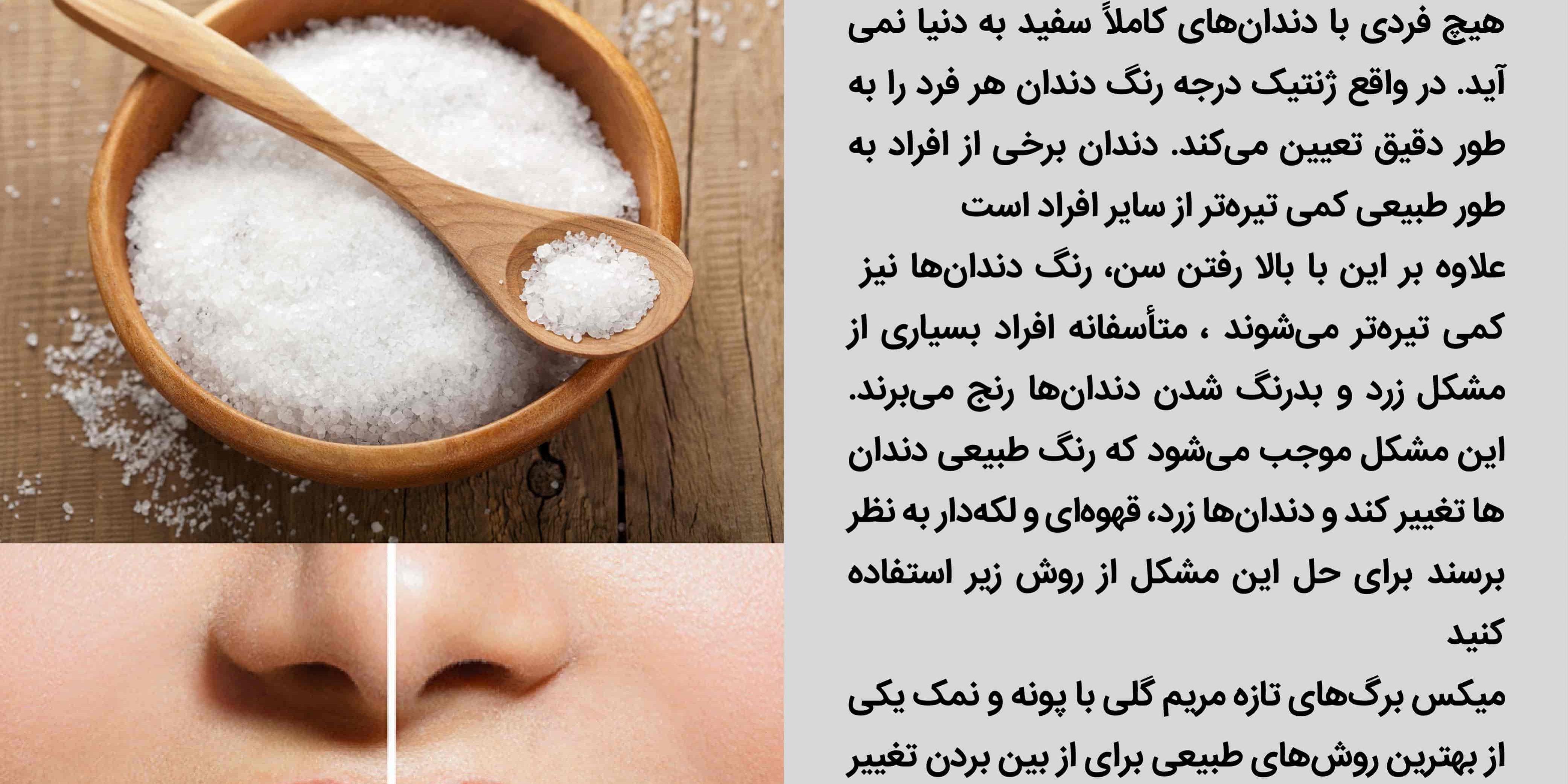 رفع زردی دندان