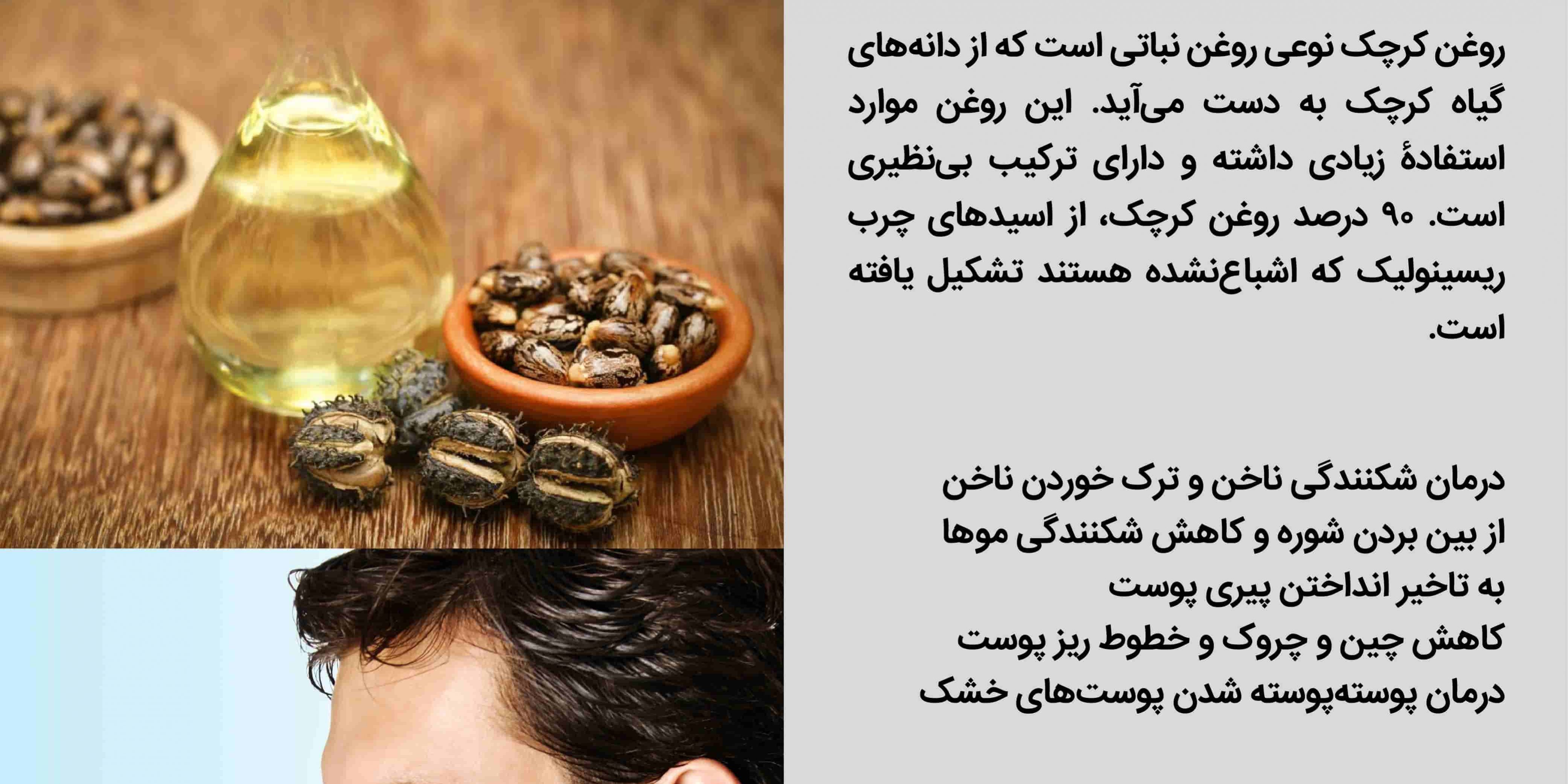 روغن کرچک