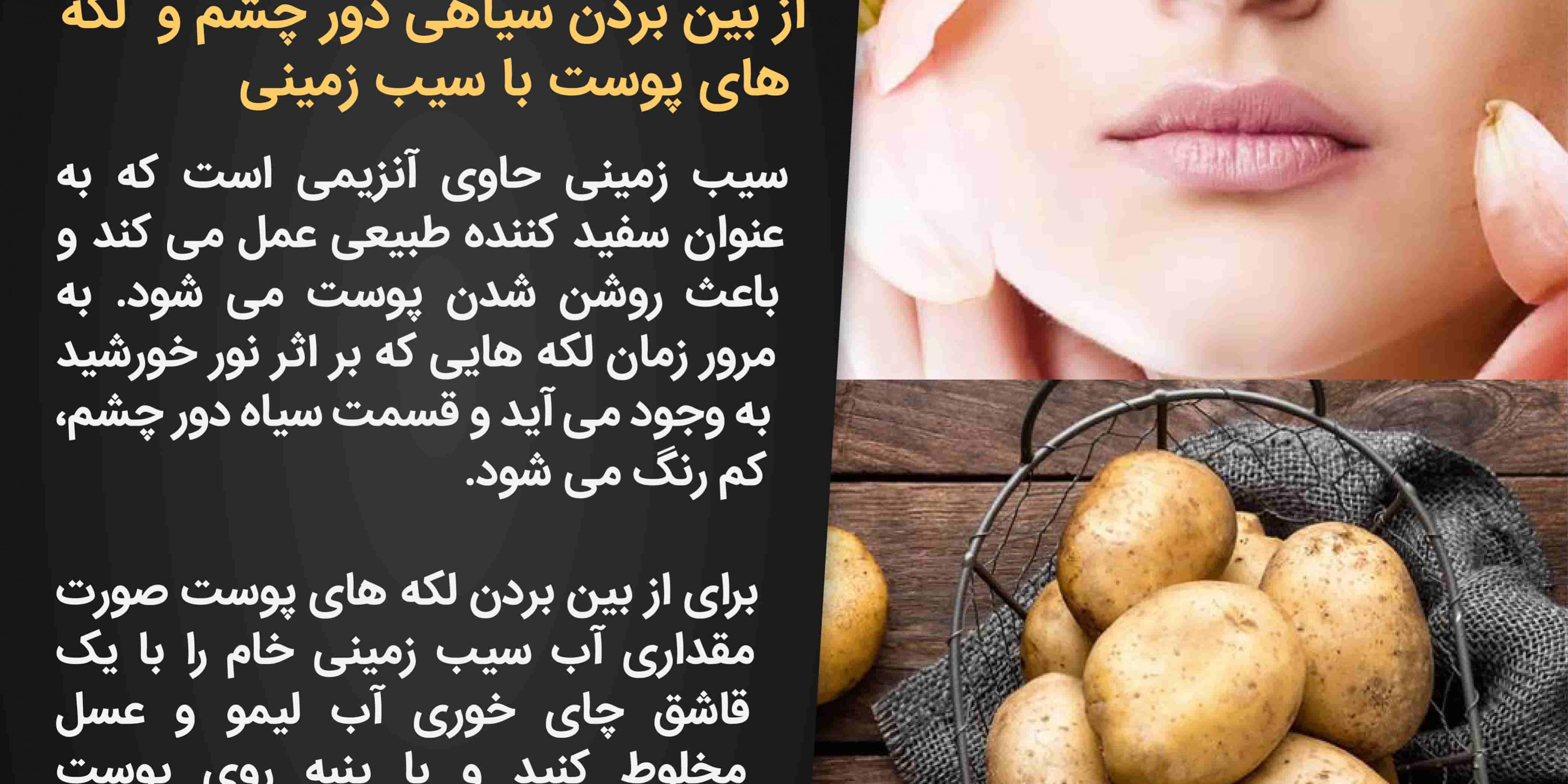 سیب زمینی و لکه های صورت