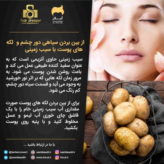 سیب زمینی و لکه های صورت