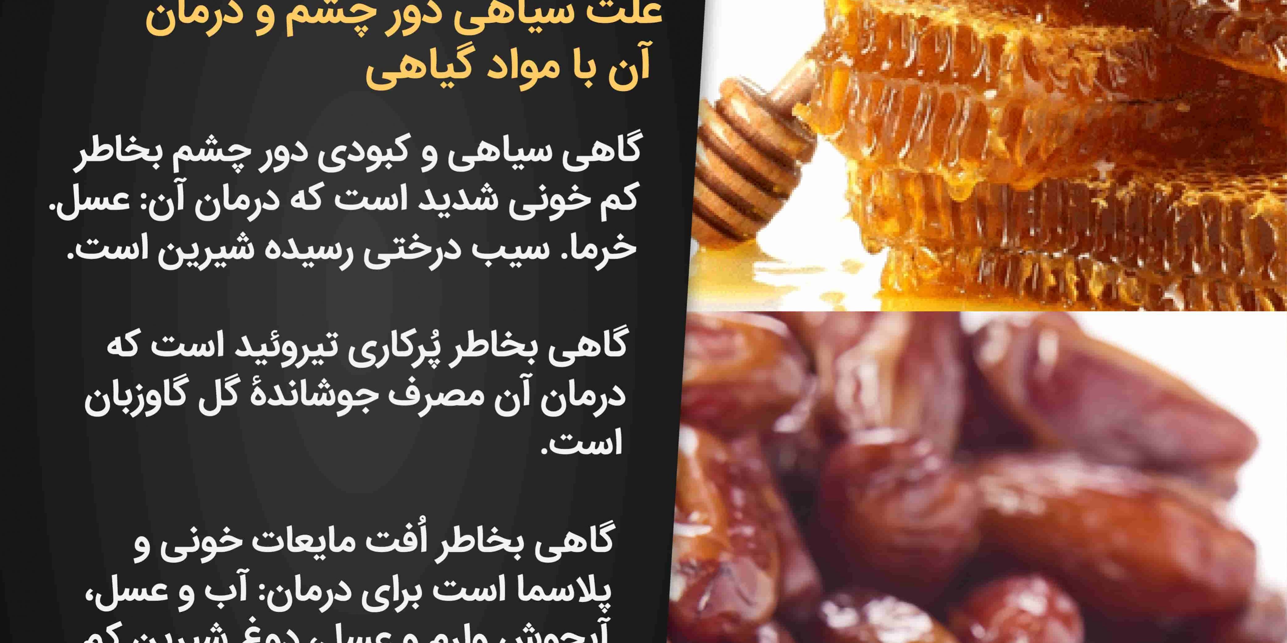 علل سیاهی دور چشم و راه درمان آن