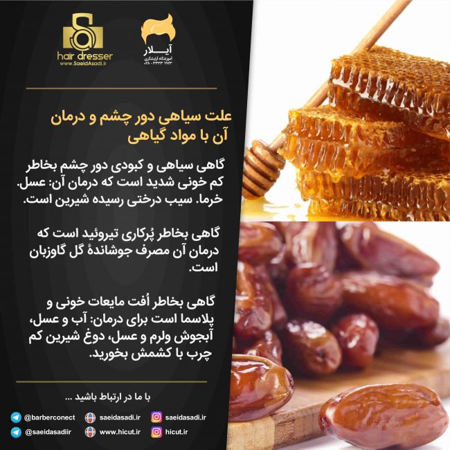 علل سیاهی دور چشم و راه درمان آن