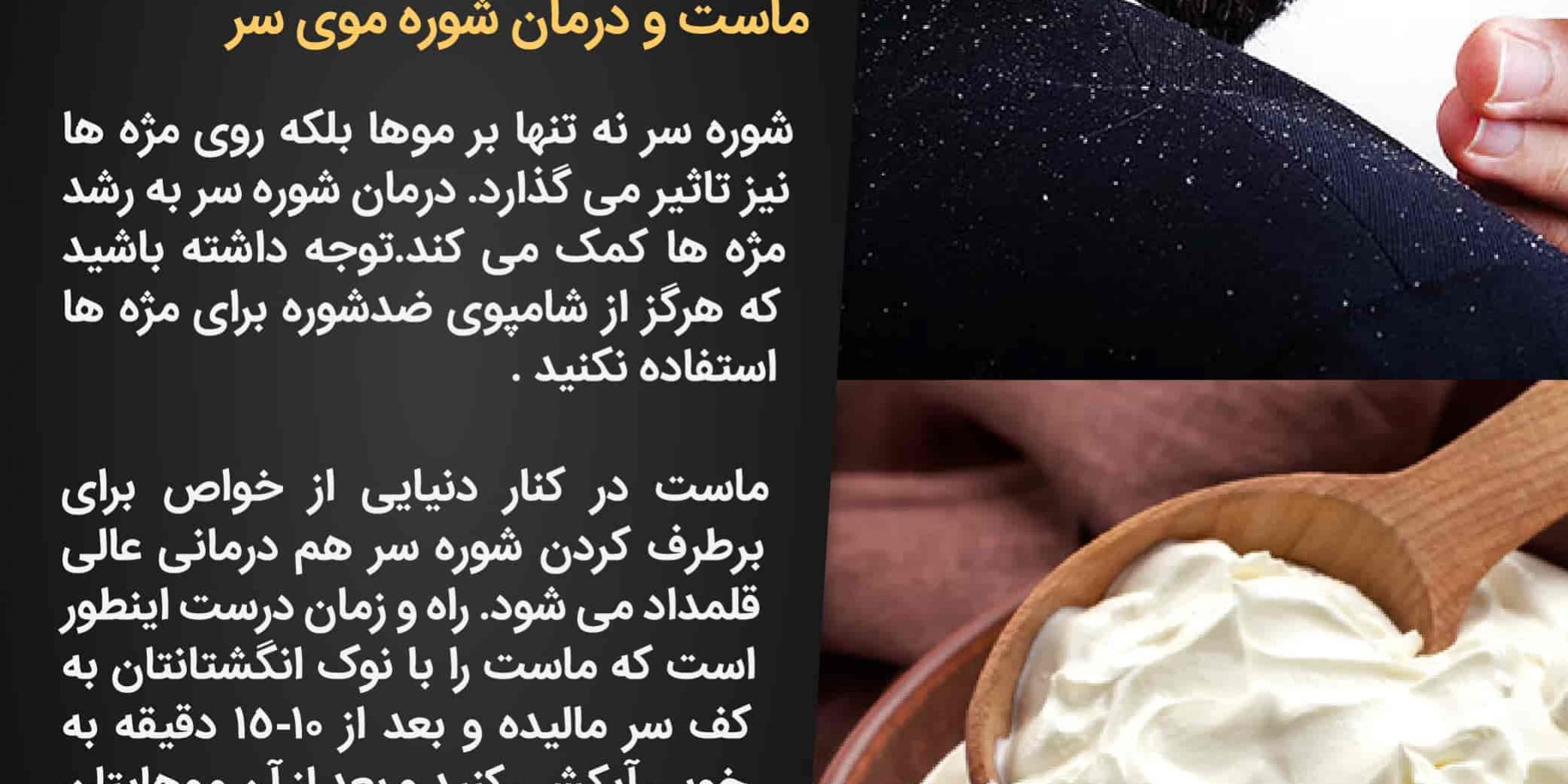 ماست و درمان شوره سر
