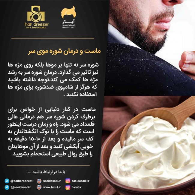 ماست و درمان شوره سر